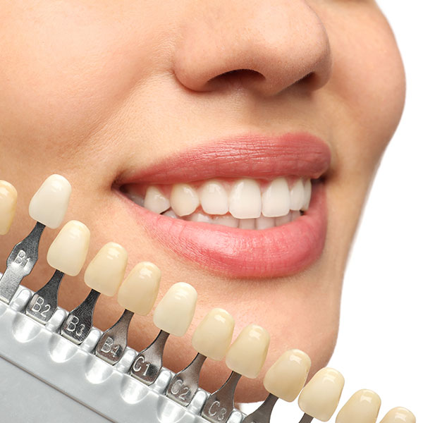 Ästhetische Zahnheilkunde in der Zahnarztpraxis Mara Tipter in Hude