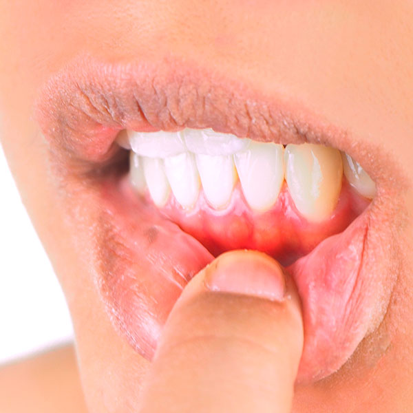 Parodontologie  in der Zahnarztpraxis Mara Tipter in Hude